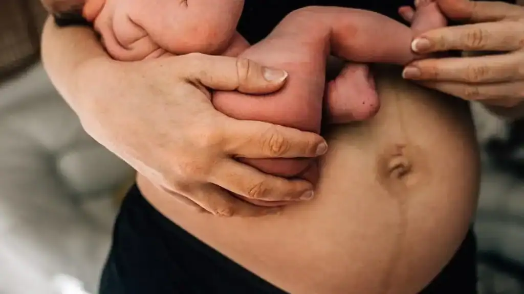 Why Is My Stomach Still Big After Pregnancy Headingley?